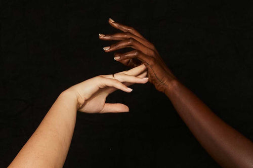 Support Equality